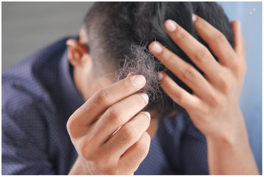Experiencing Hair Loss - What You Can Do About It